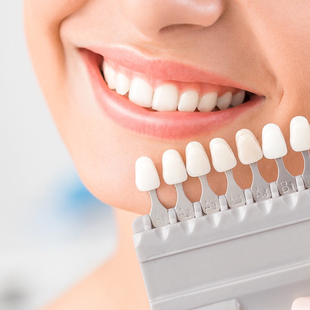 Treatments - Expert dental services in Hungary - Access-Smile
