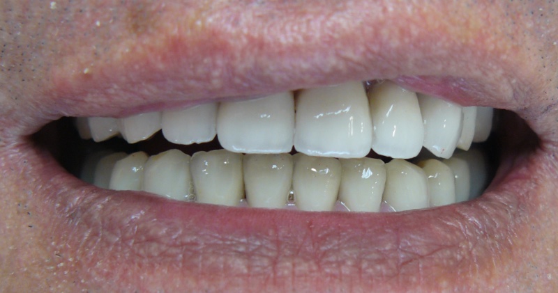 Case Studies - Expert dental services in Hungary - Access-Smile