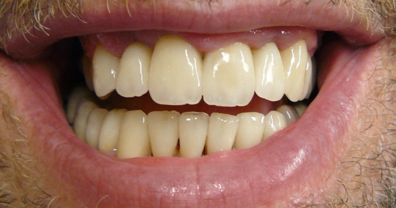 Case Studies - Expert dental services in Hungary - Access-Smile